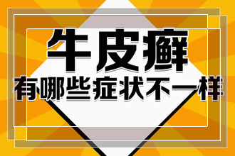 患了红皮型牛皮癣应该怎么做能对病情有帮助