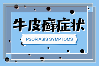 祖辈中出现牛皮肤癣皮肤病会隔代遗传给我们的下一代吗