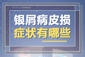 出现在患者里面很常见的牛皮癣皮肤病 有哪些