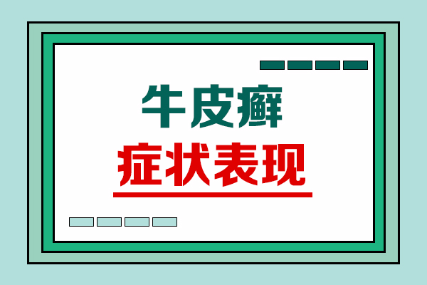 头上长牛皮癣的[症状图片]，头部牛皮癣该如何治疗?